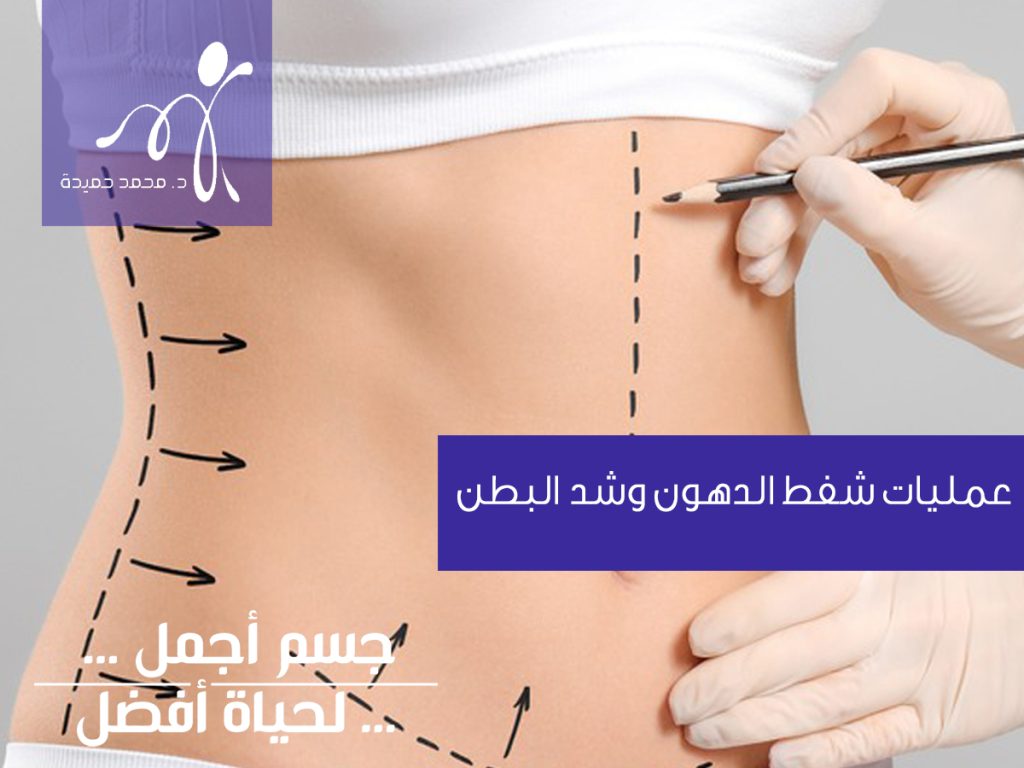 عمليات شفط الدهون