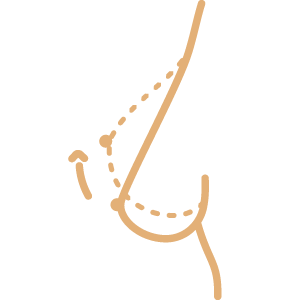  تكبير الثدي