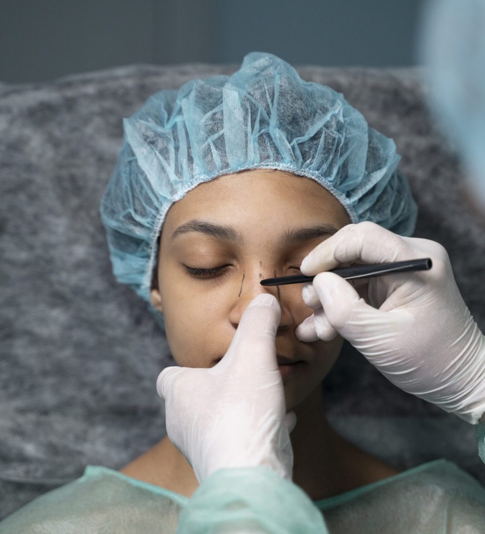Rhinoplasty (1)